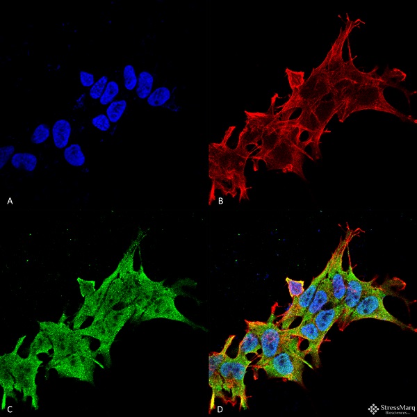 抗LRRK2/Dardarin抗体 (#SMC-445)を用いたヒト神経芽細胞腫細胞株の免疫染色像