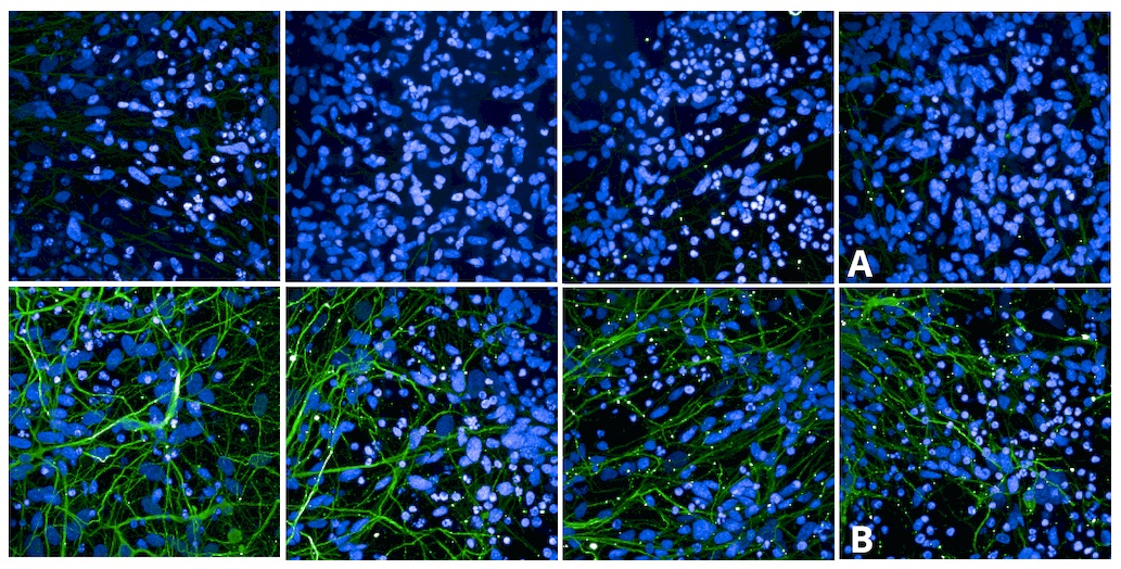 抗Tau抗体 (#SMC-601)を用いたiPSC由来皮質興奮性神経細胞の蛍光免疫染色像