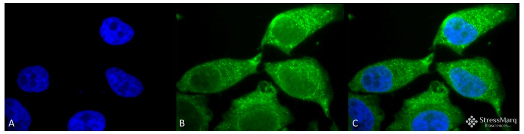 抗SOD (EC)抗体 (#SMC-124D)を用いたHeLa細胞の蛍光免疫染色像