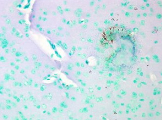 抗Cav1.2 Ca2+ Channel抗体 (#SMC-300D)を用いたマウス脳組織の免疫染色像