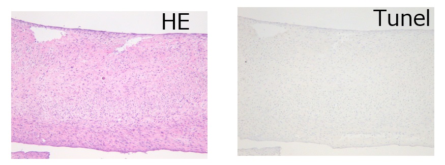 ヒト線維芽細胞スフェロイド染色画像