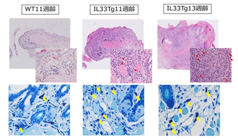 アトピー性皮膚炎モデル（IL33-Tgマウス）病理検査