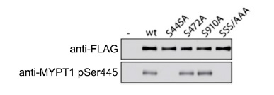 抗MYPT1 (myosin phosphatase target subunit 1、ミオシンホスファターゼ)抗体の使用例