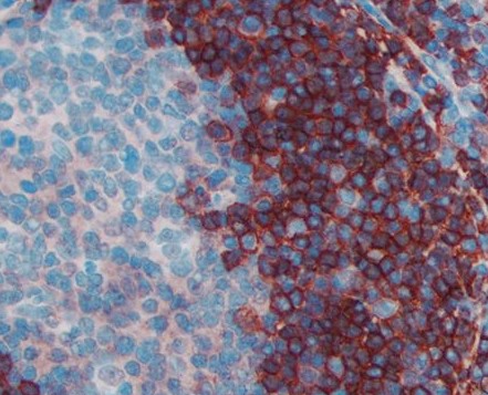 #MP-7444を用いたヒト扁桃腺組織の免疫組織染色像