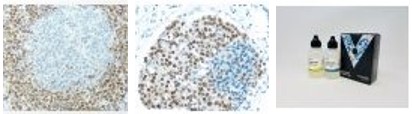 ImmPRESS Reagentの免疫組織染色像と製品画像