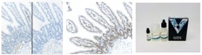 M.O.M. ImmPRESSの免疫組織染色像と製品画像