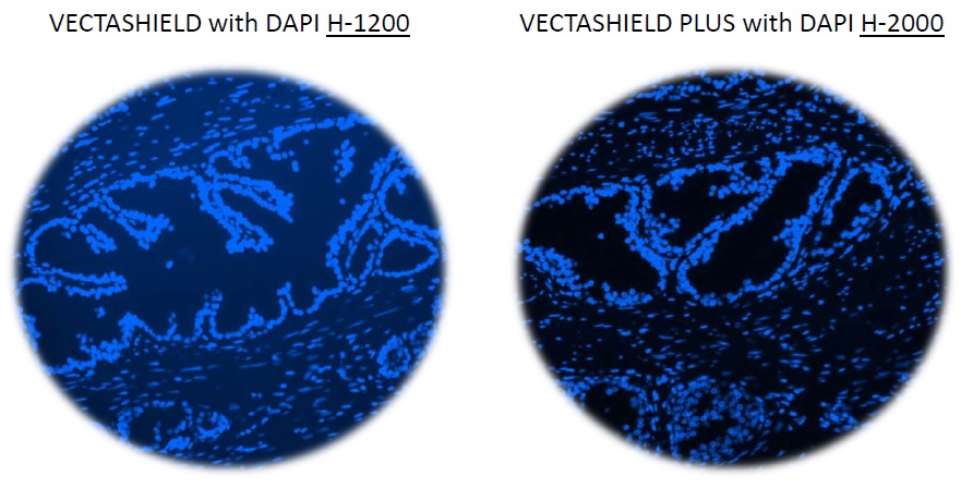 VECTASHIELD with DAPI H-1200とVECTASHIELD-PLUS with DAPI H-2000との比較
