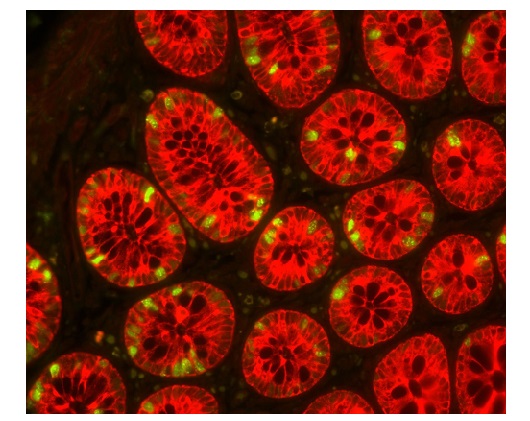 ヒト結腸の蛍光免疫二重染色像