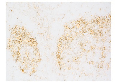 ヒト扁桃腺凍結組織切片のH.O.H Kit染色画像