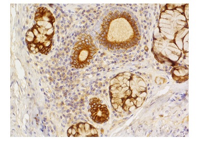 ヒト扁桃腺FFPE組織切片のPre-Complex染色画像