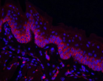 マウス舌の内皮細胞の免疫蛍光染色像