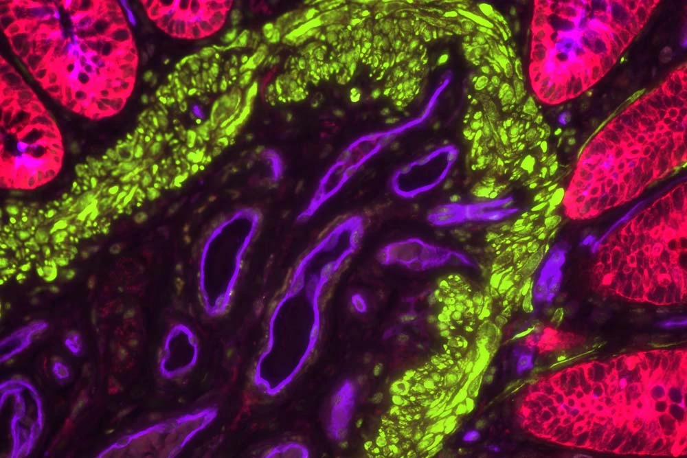 ヒト大腸組織の免疫蛍光染色像