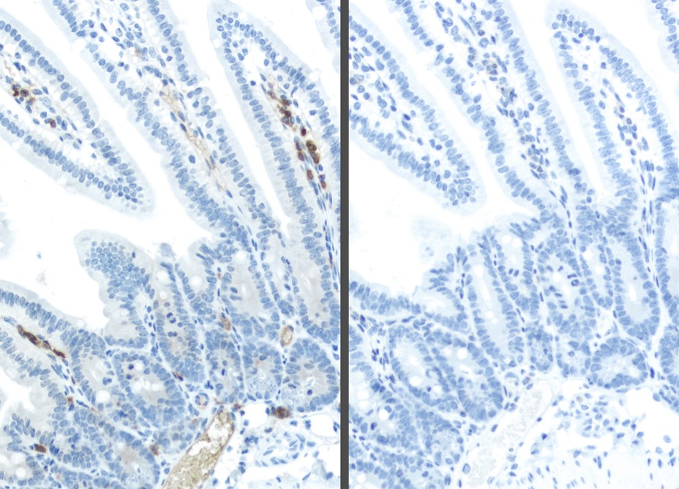 M.O.M. ImmPRESS reagentまたはHRP標識二次抗体で染色したマウス腸組織の比較