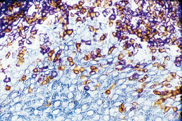VECTASTAIN Universal Elite ABC Kit（#PK-6200）による扁桃腺のホルマリン固定／パラフィン包埋切片の免疫染色画像