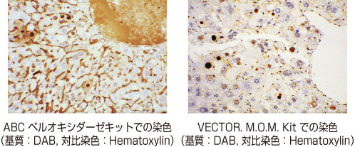 マウス肝臓パラフィン切片のPCNA免疫染色