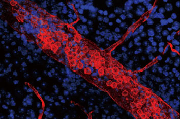#DL-1177で灌流したマウス平坦封入網膜の血管組織