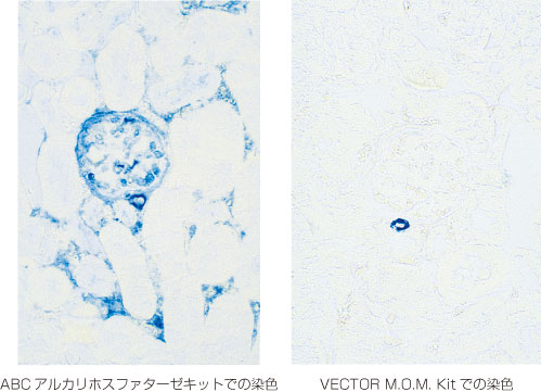 マウス腎臓組織切片の平滑筋アクチン免疫染色