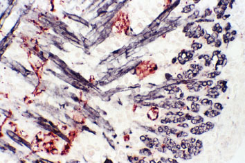 M.O.M. Peroxidase Kitを用いた新生マウス舌組織切片の免疫染色