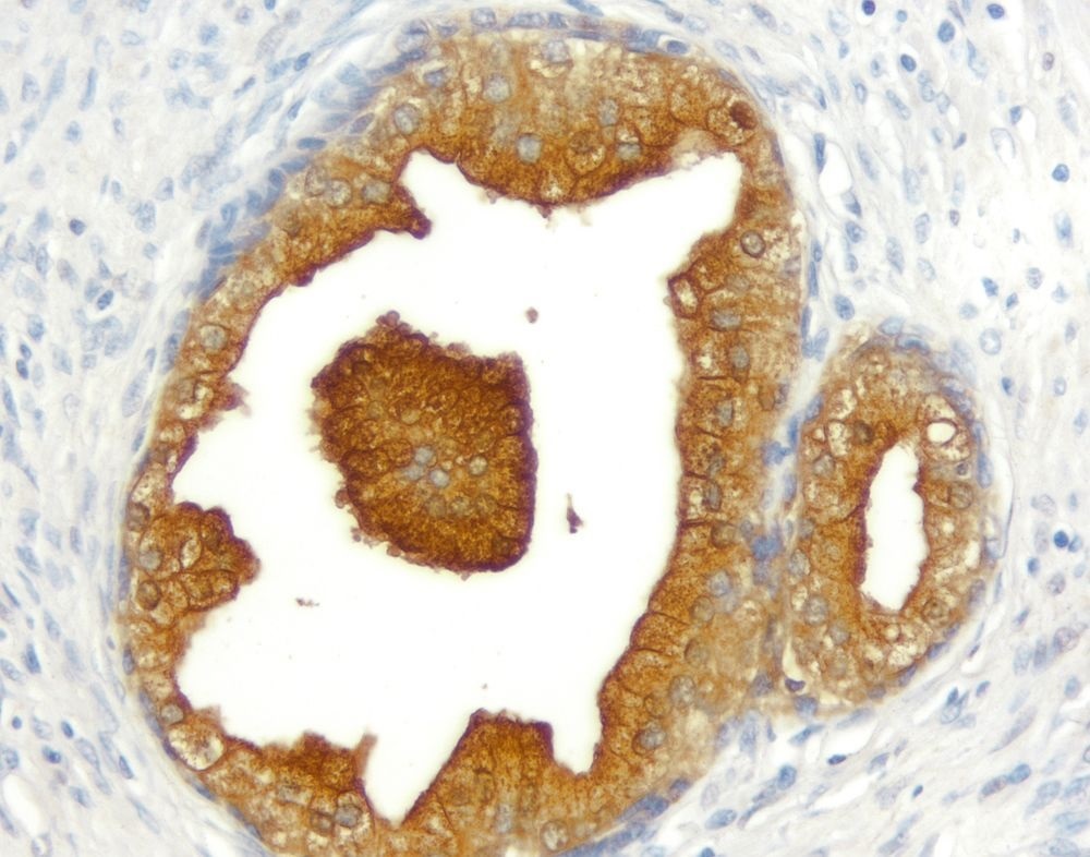 ImmPRESS Reagent Anti-Goat IgG（HRP）を使用した前立腺組織の染色例