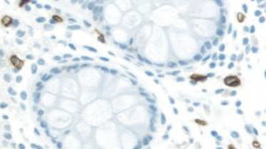 大腸の抗CD34マウスモノクローナル抗体による免疫染色