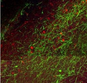 Rat Brain 20X, Rab‐cFos （red‐546 ）/mo NFH‐AH1 （green‐488）/Dapi （blue‐405）, 50μm）