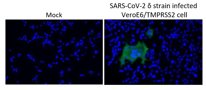 抗SARS-CoV-2 NCP抗体を用いた免疫細胞染色像