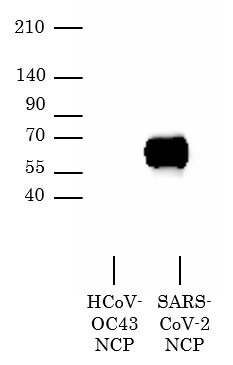 抗SARS-CoV-2 NCP抗体を用いたウエスタンブロッティング像