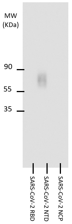 抗SARS-CoV-2 NTD抗体を用いたウエスタンブロッティング像