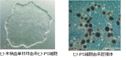 胚様体形成によるiPS細胞の分化能確認試験