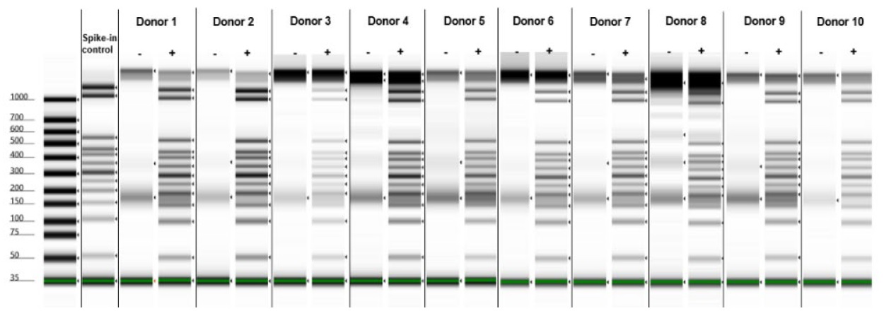 異なるドナー由来の血漿からの本キットを用いたcfDNAの抽出