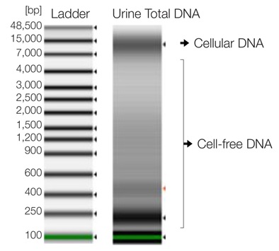 尿試料中の細胞由来DNAおよびセルフリーDNAを抽出・精製するキット「Quick-DNA Urine Kit」の使用例2