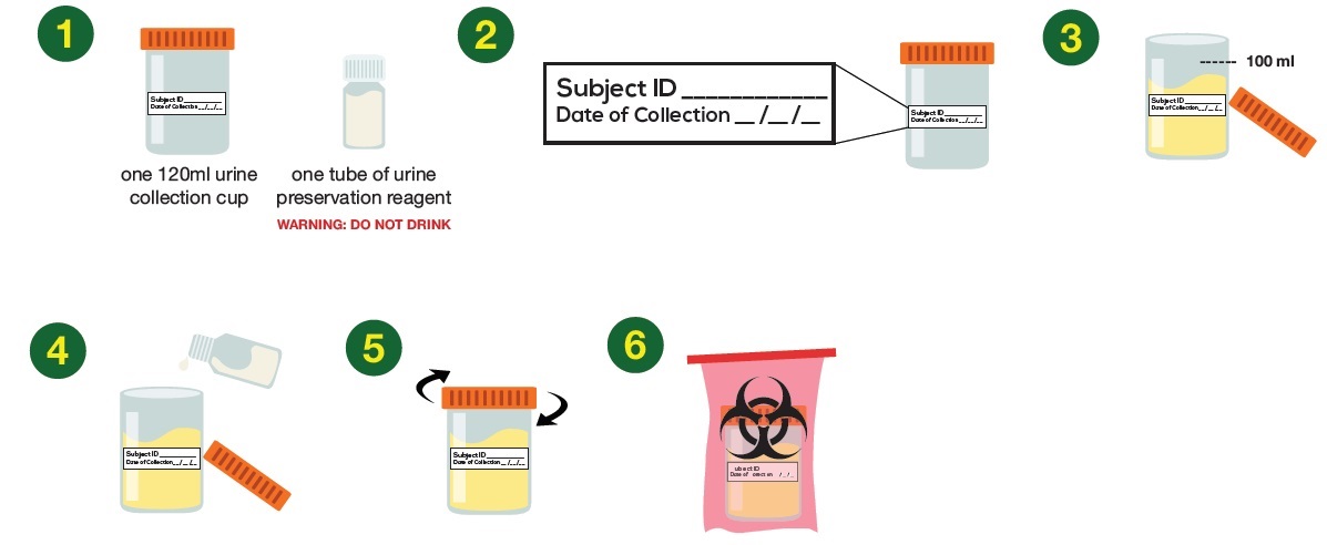 Urine Collection Kit操作法概略