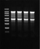 RNA Easy Measurement N under Denaturing agarose gel