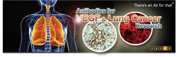 VEGF経路および腫瘍環境研究用抗体